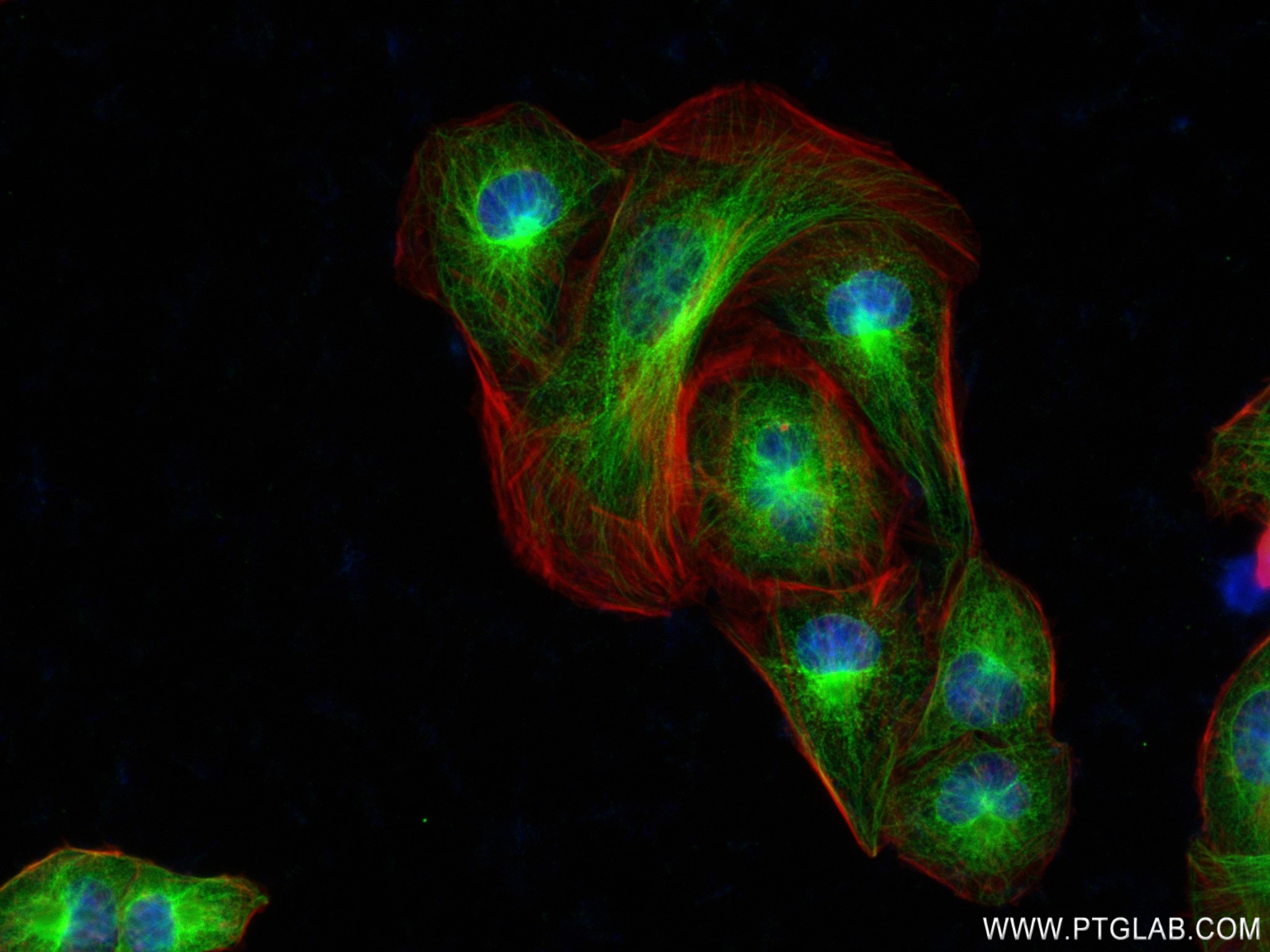 IF Staining of U2OS using 83082-4-RR (same clone as 83082-4-PBS)
