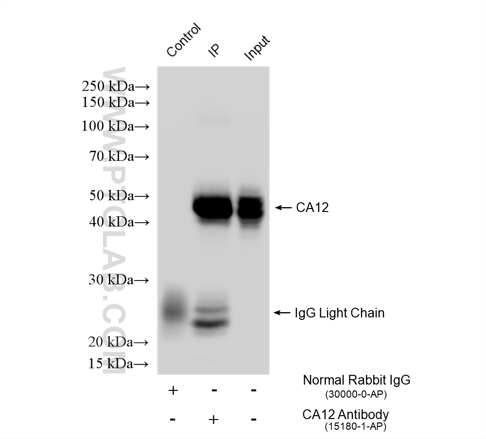 IP experiment of A549 using 15180-1-AP