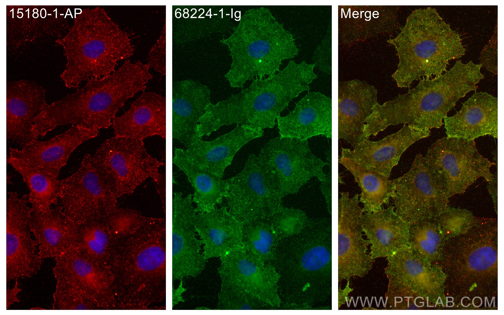 IF Staining of A549 using 68224-1-Ig