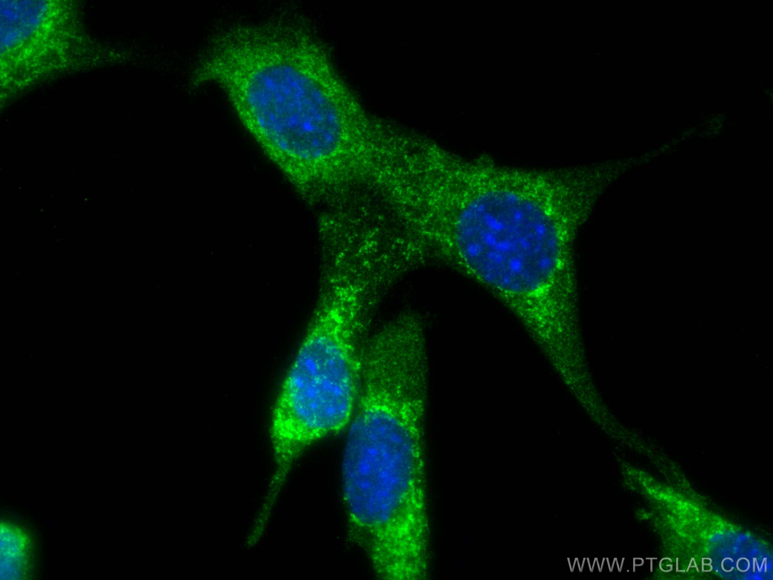 IF Staining of NIH/3T3 using 16696-1-AP (same clone as 16696-1-PBS)