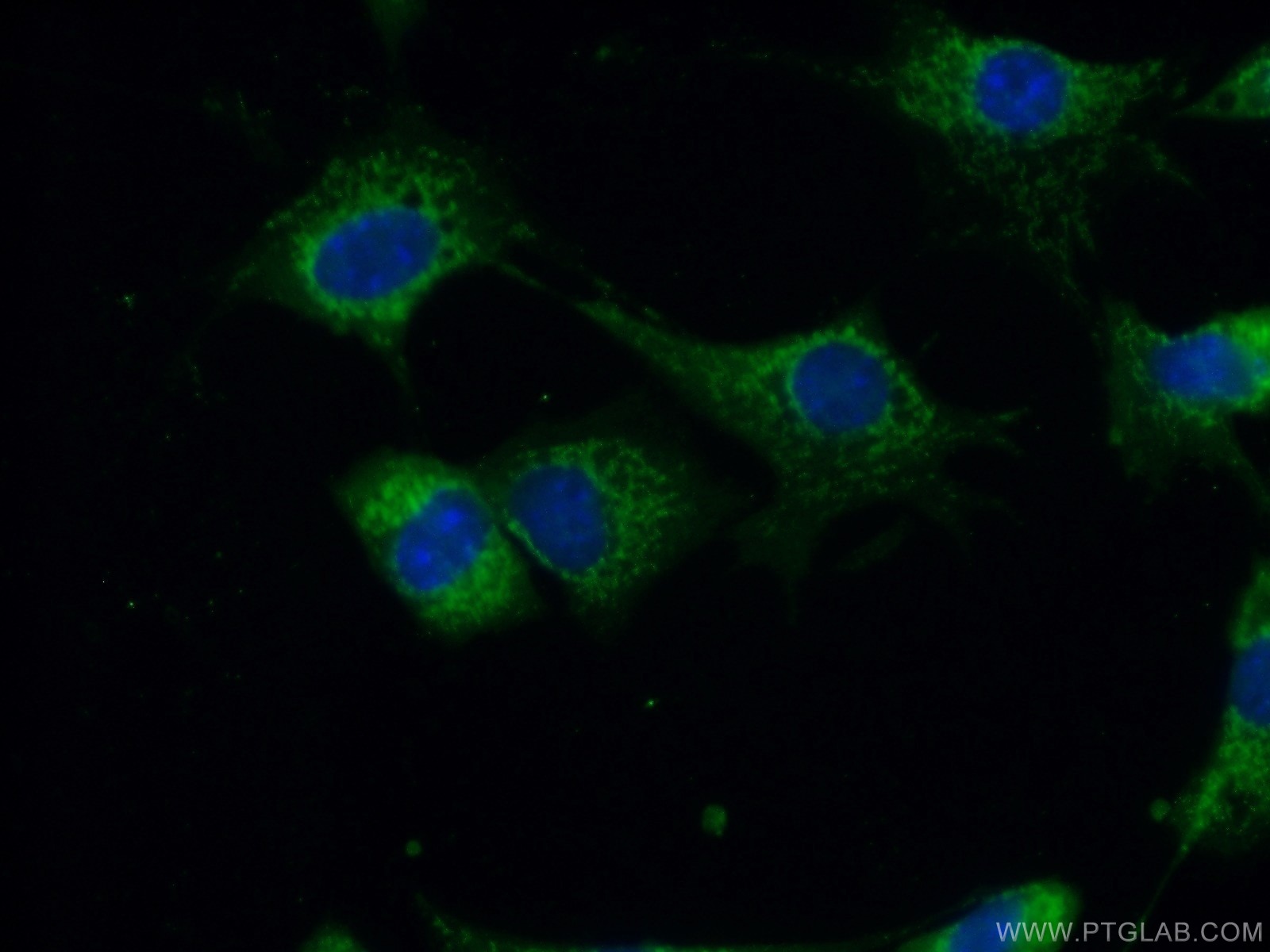 IF Staining of NIH/3T3 using 16696-1-AP