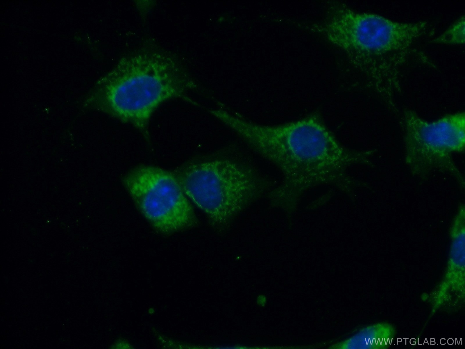 IF Staining of NIH/3T3 using 16696-1-AP (same clone as 16696-1-PBS)
