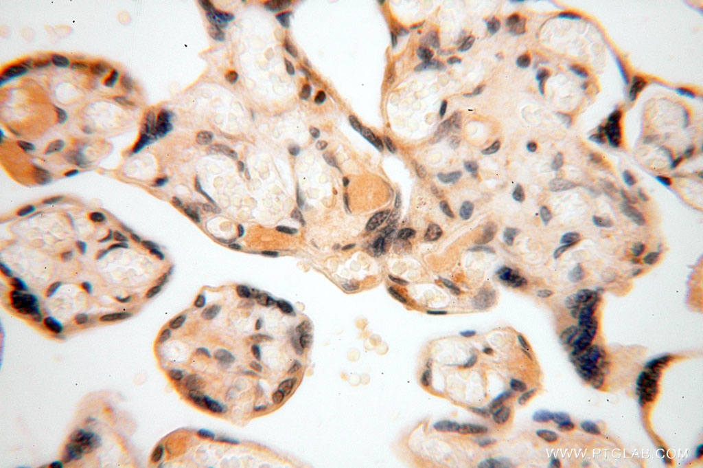 IHC staining of human placenta using 16696-1-AP