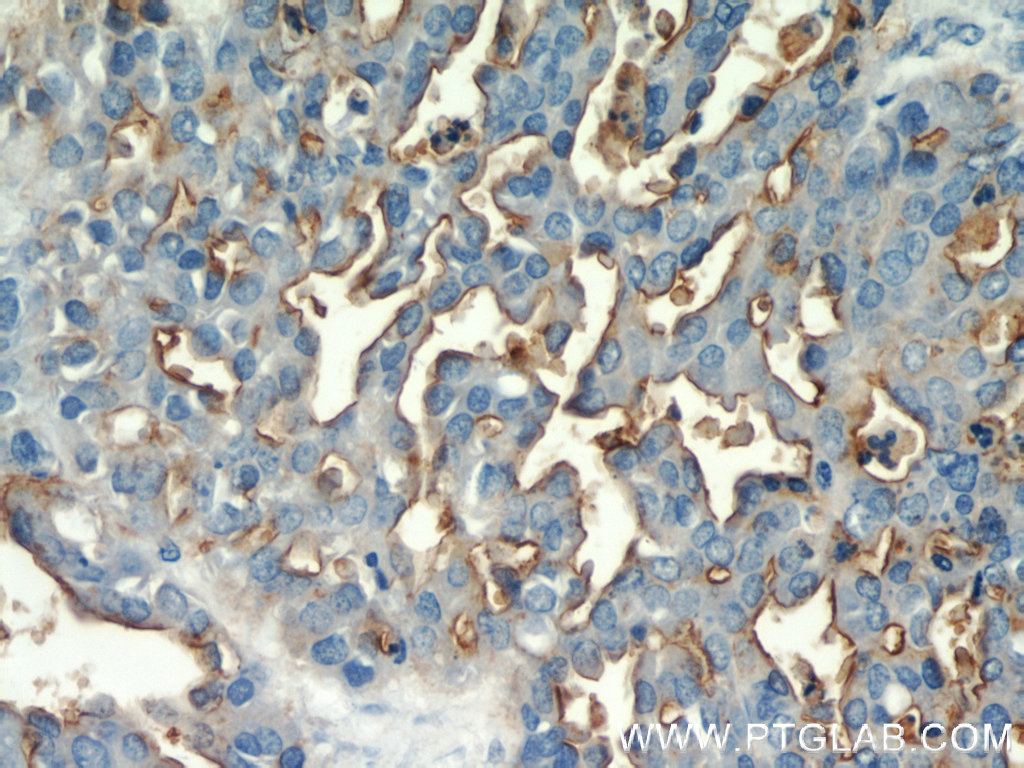 MUC1/CA15-3 C-terminal Polyclonal antibody