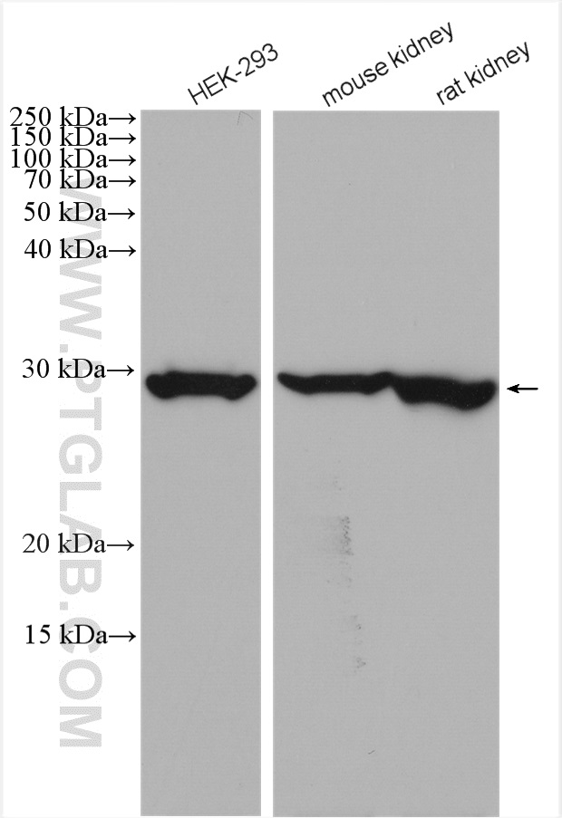 WB analysis using 16961-1-AP