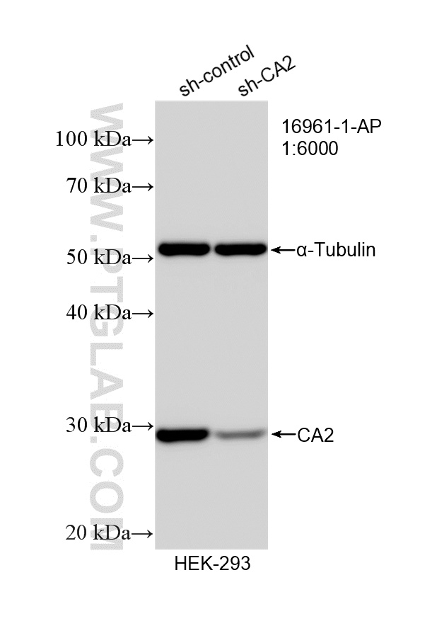 WB analysis of HEK-293 using 16961-1-AP WB analysis of HEK-293 using 16961-1-AP