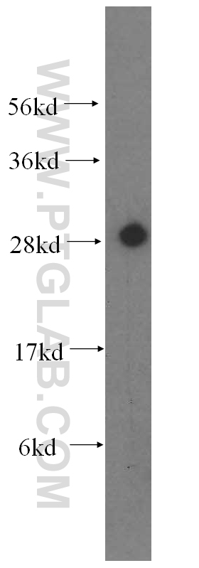 CA2 Polyclonal antibody
