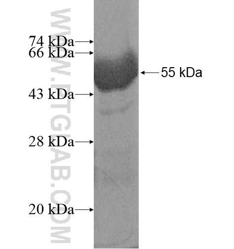CA2 fusion protein Ag10680 SDS-PAGE