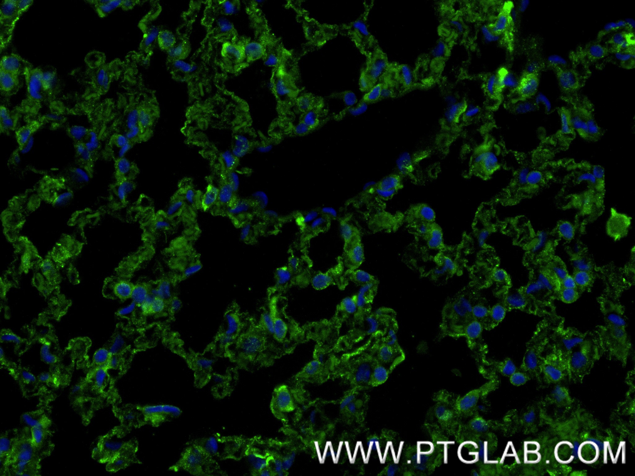 IF Staining of mouse lung using 85706-1-RR (same clone as 85706-1-PBS) IF Staining of mouse lung using 85706-1-RR (same clone as 85706-1-PBS)