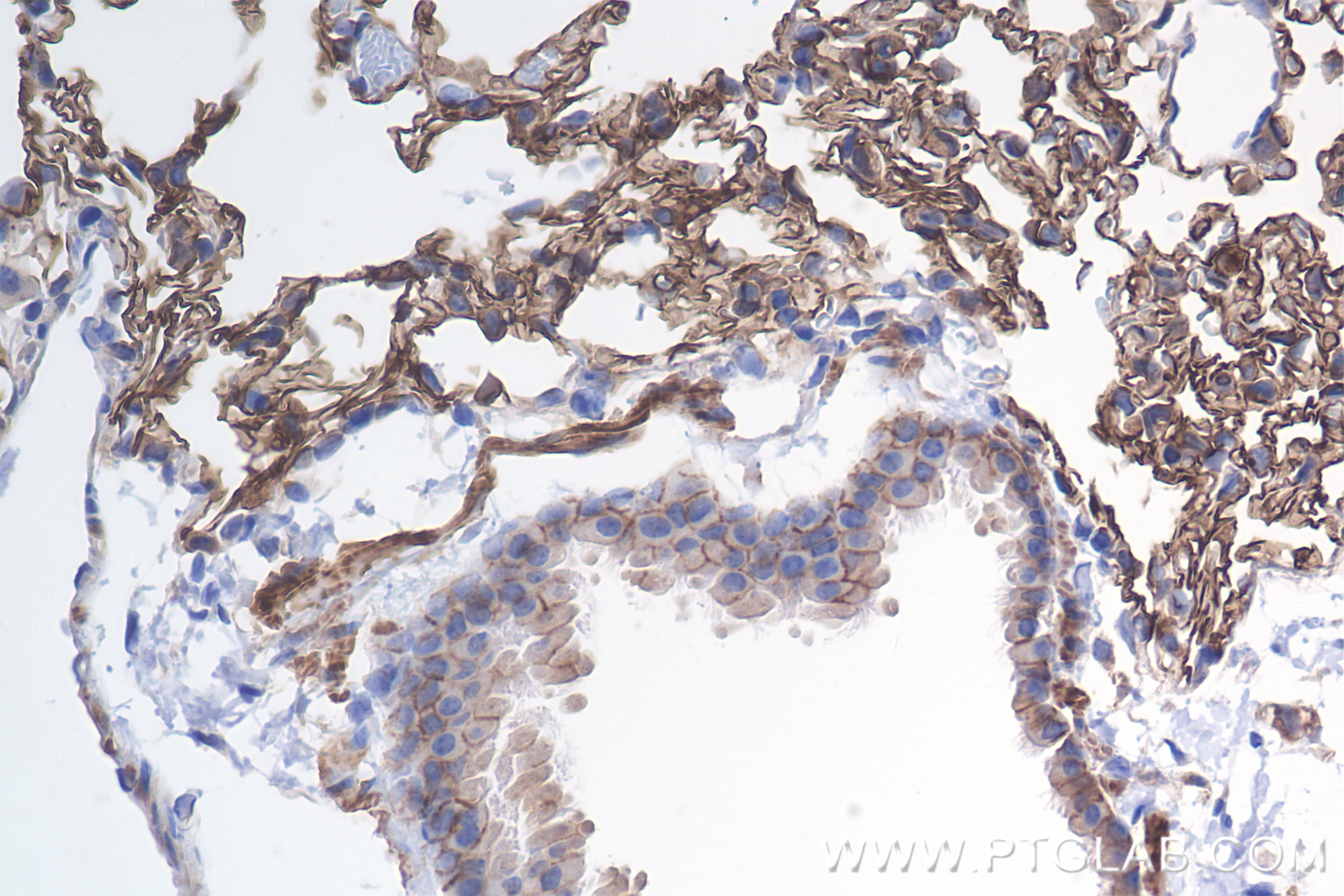 IHC staining of mouse lung using 85706-1-RR