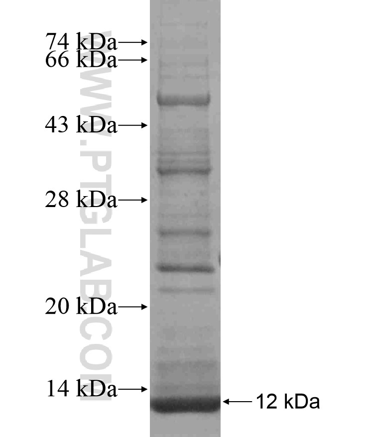 CA5A fusion protein Ag17689 SDS-PAGE