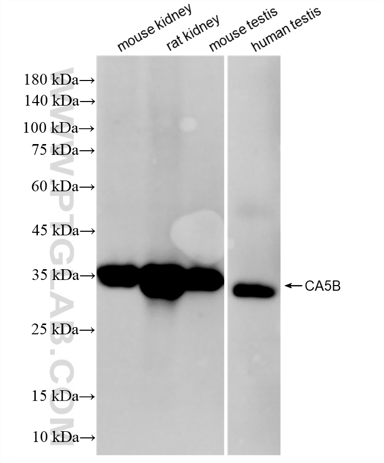 Various lysates were subjected to SDS PAGE followed by western blot with <a class='green' href='/productredirect?CatalogNo=86996-1-RR' target='_blank'>86996-1-RR</a> (CA5B antibody) at dilution of 1:5000 incubated at room temperature for 1.5 hours. This data was developed using the same antibody clone with 86996-1-PBS in a different storage buffer formulation. WB analysis using 86996-1-RR (same clone as 86996-1-PBS)