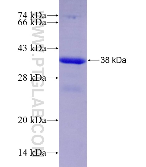 CA5B fusion protein Ag28650 SDS-PAGE CA5B fusion protein Ag28650 SDS-PAGE