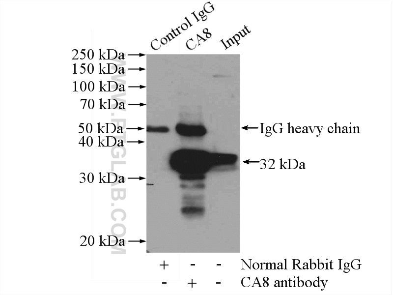 IP experiment of mouse brain using 12391-1-AP