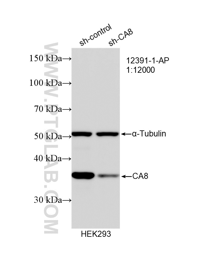 WB analysis of HEK-293 using 12391-1-AP