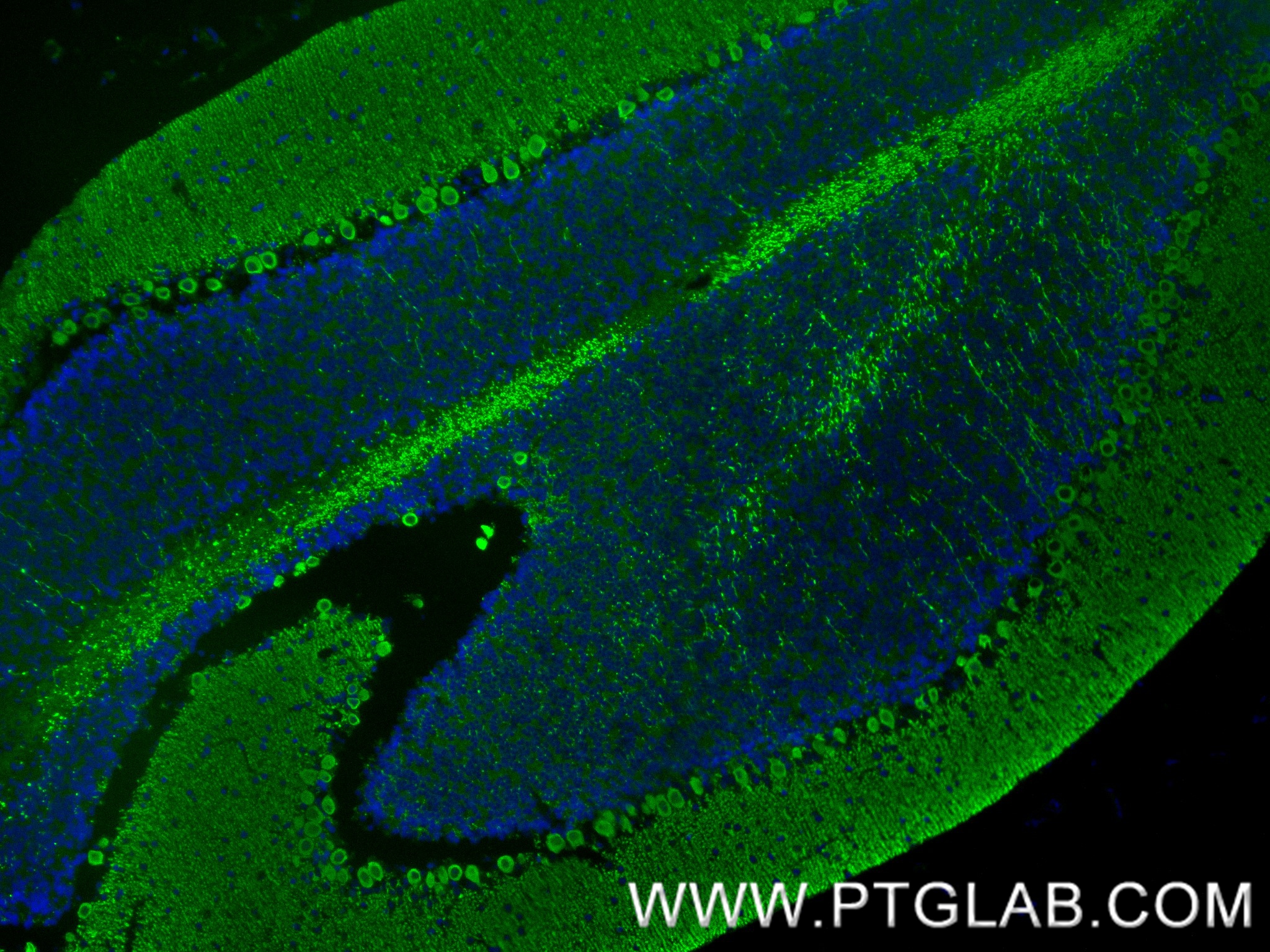 IF Staining of mouse cerebellum using 86004-1-RR