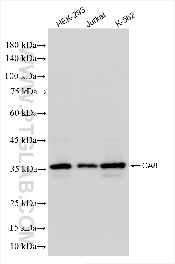 WB analysis using 86004-2-RR