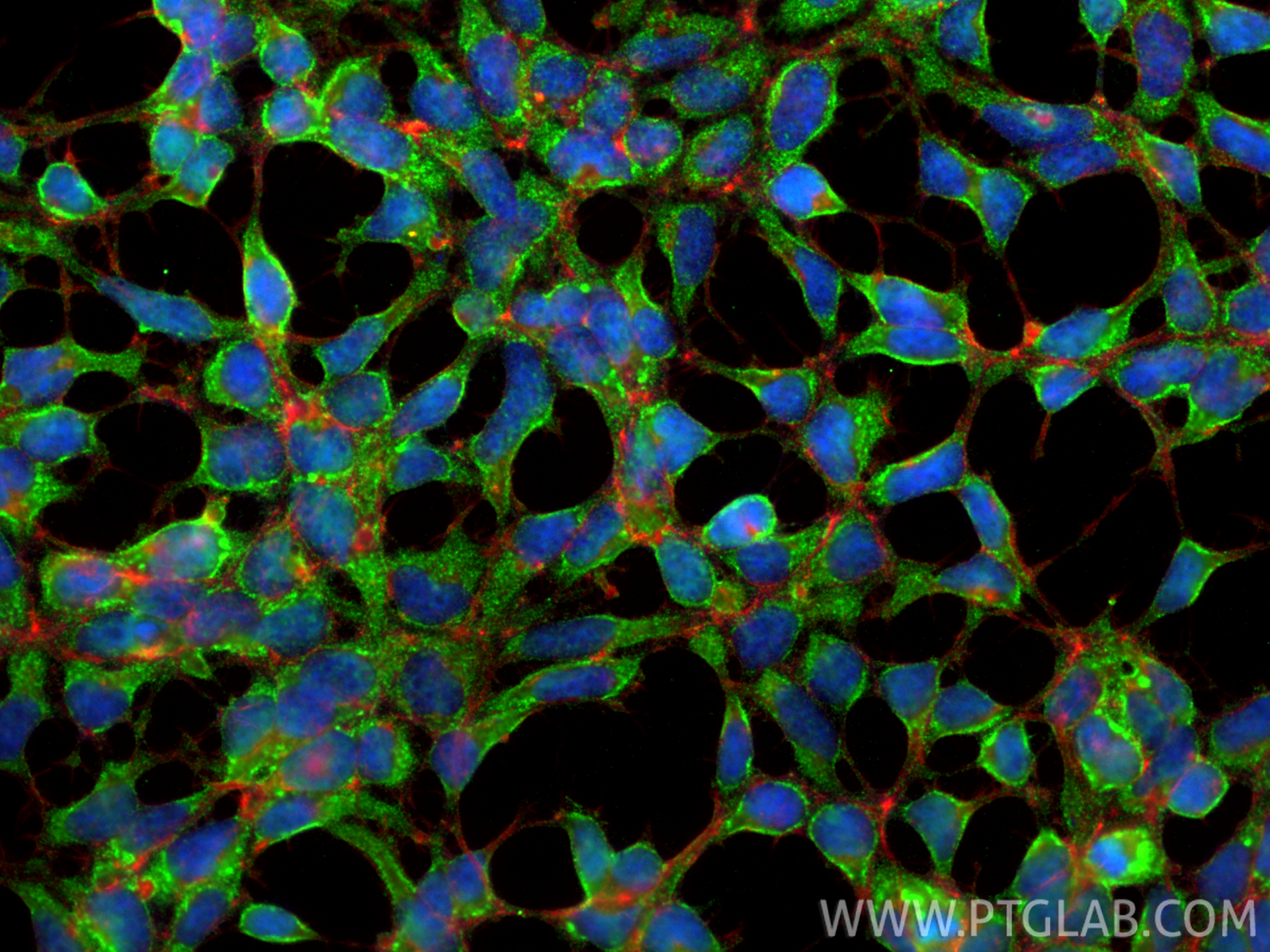 Immunofluorescent analysis of (-20°C Ethanol) fixed HEK-293 cells using Carbonic Anhydrase IX/CA9 antibody (11071-1-AP) at dilution of 1:400 and CoraLite®488-Conjugated Goat Anti-Rabbit IgG(H+L) (<a class='green' href='/productredirect?CatalogNo=SA00013-2' target='_blank'>SA00013-2</a>), CL594-Phalloidin (red). IF Staining of HEK-293 using 11071-1-AP