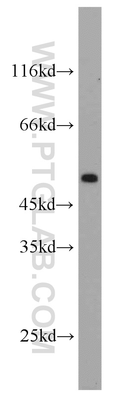 WB analysis of mouse brain using 11443-1-AP