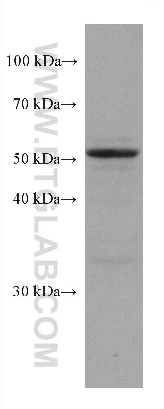 WB analysis of U-87 MG using 66243-1-Ig