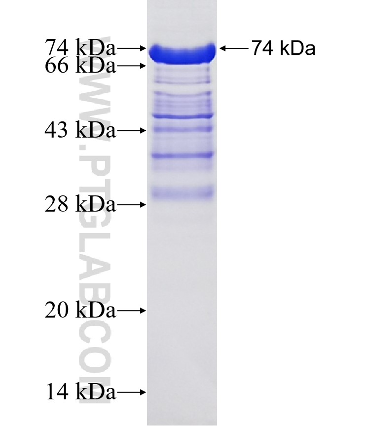 CA9 fusion protein Ag1256 SDS-PAGE CA9 fusion protein Ag1256 SDS-PAGE