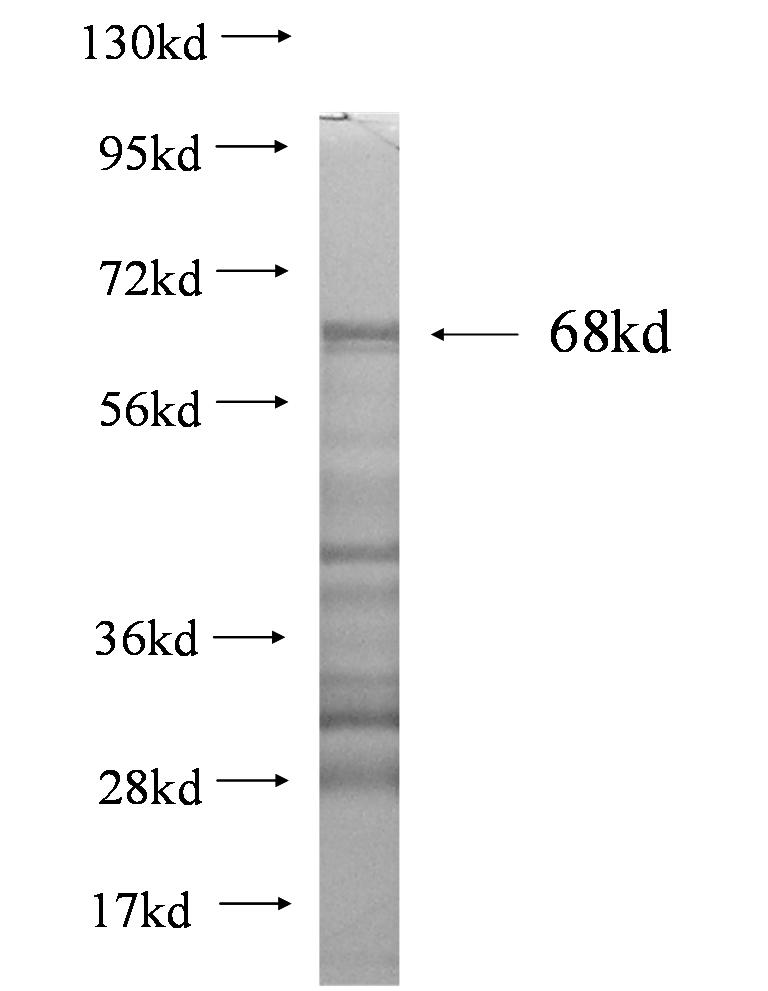 CA9 fusion protein Ag1540 SDS-PAGE