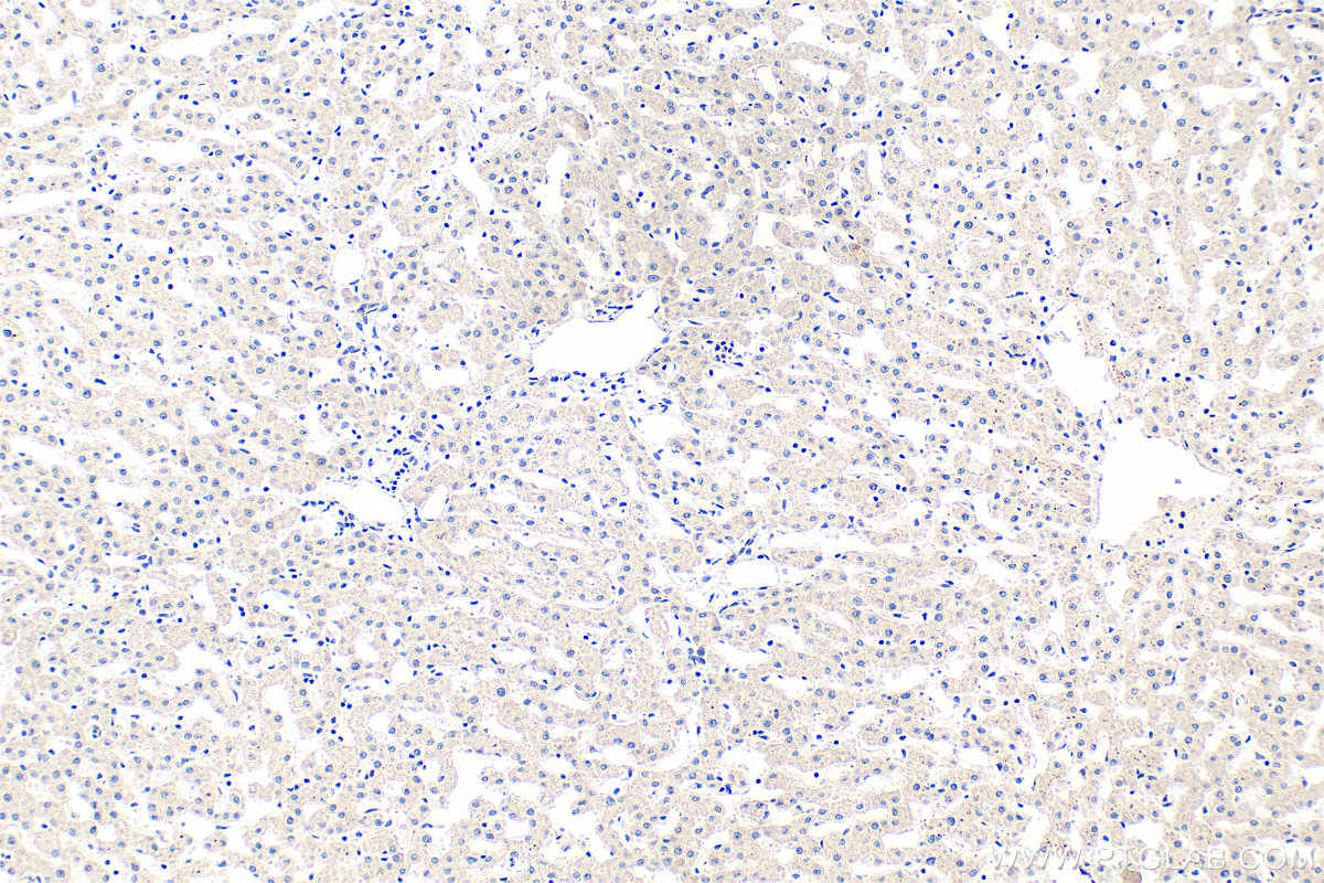 IHC staining of human liver using 26213-1-AP