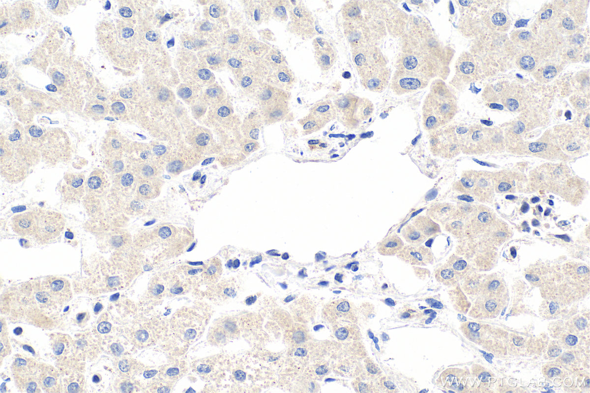 IHC staining of human liver using 26213-1-AP
