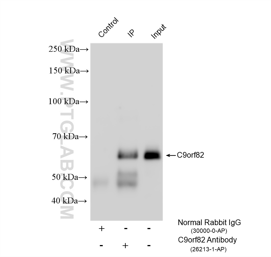IP experiment of A431 using 26213-1-AP