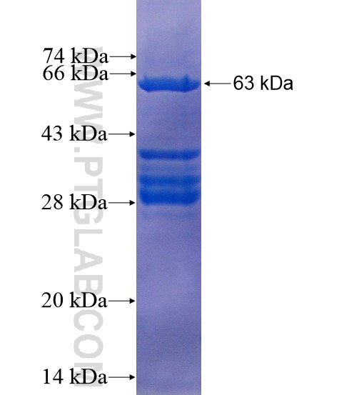 CAB39L fusion protein Ag9181 SDS-PAGE
