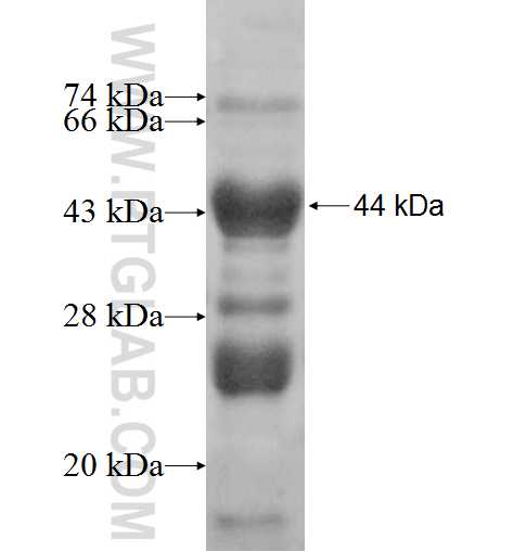 CABC1 fusion protein Ag7509 SDS-PAGE CABC1 fusion protein Ag7509 SDS-PAGE