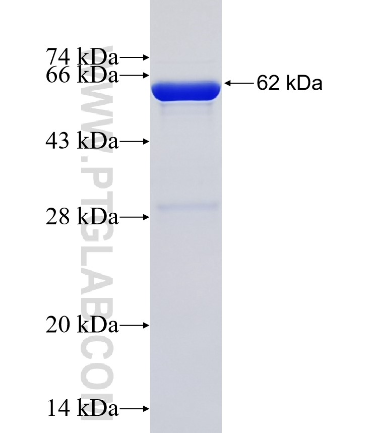 CABIN1 fusion protein Ag35666 SDS-PAGE