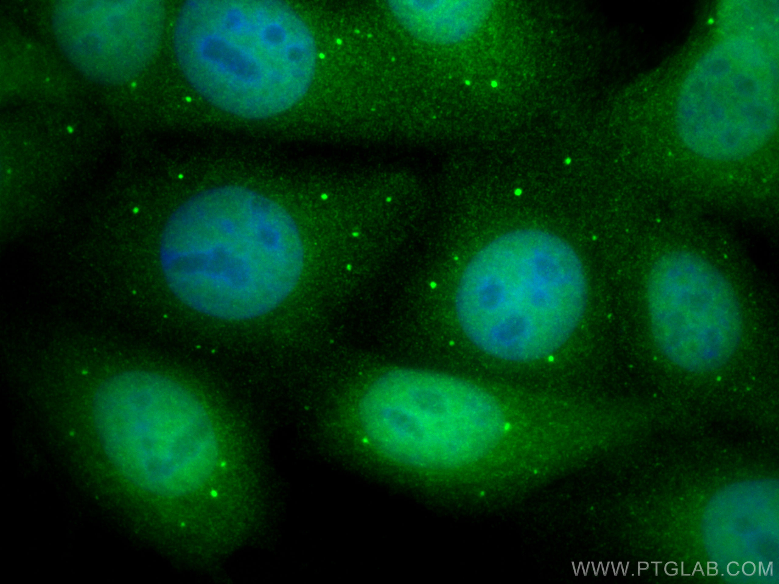 IF Staining of MCF-7 using 13464-1-AP