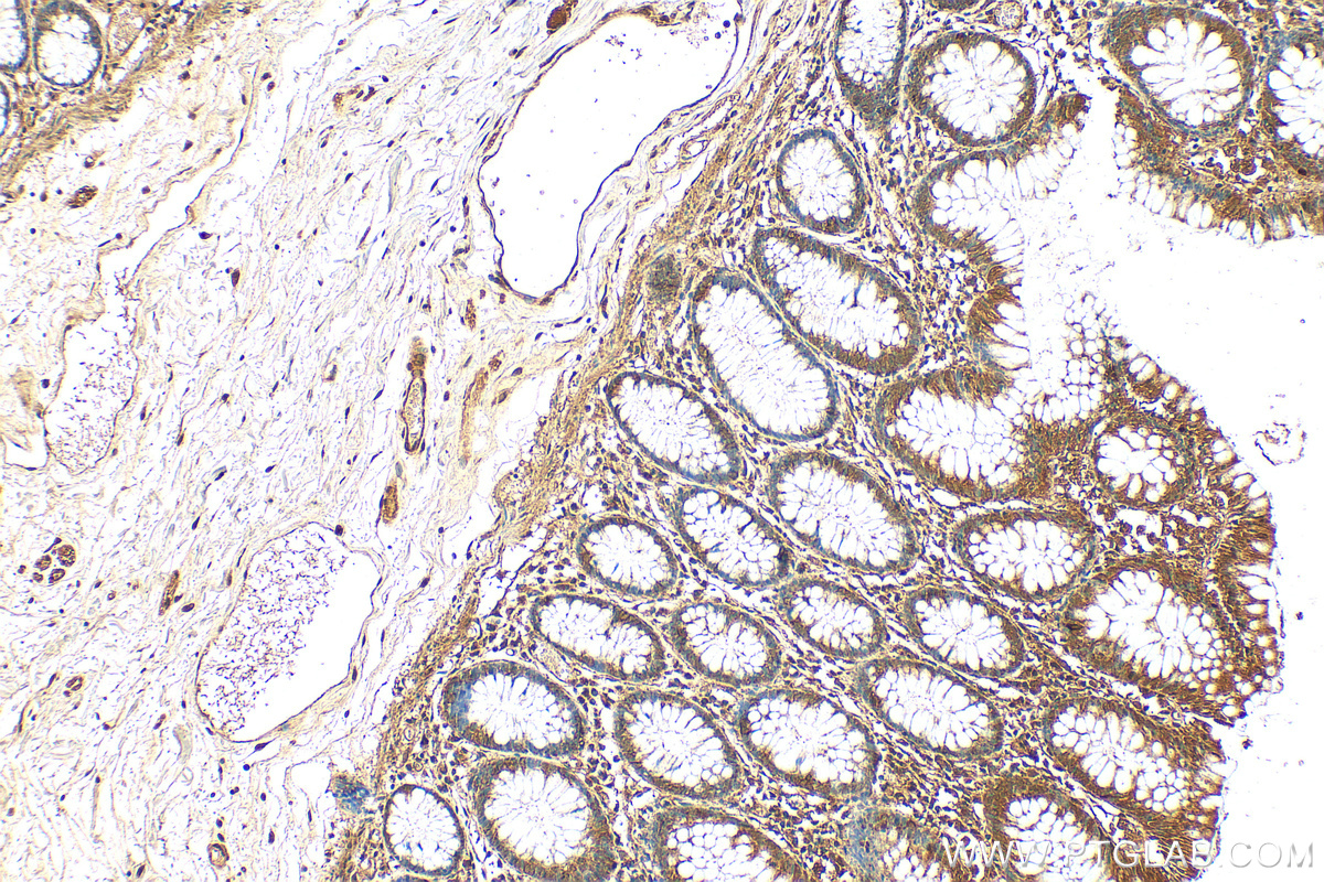 IHC staining of human colon using 13464-1-AP
