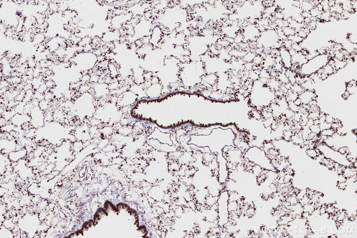 IHC staining of rat lung using 13464-1-AP