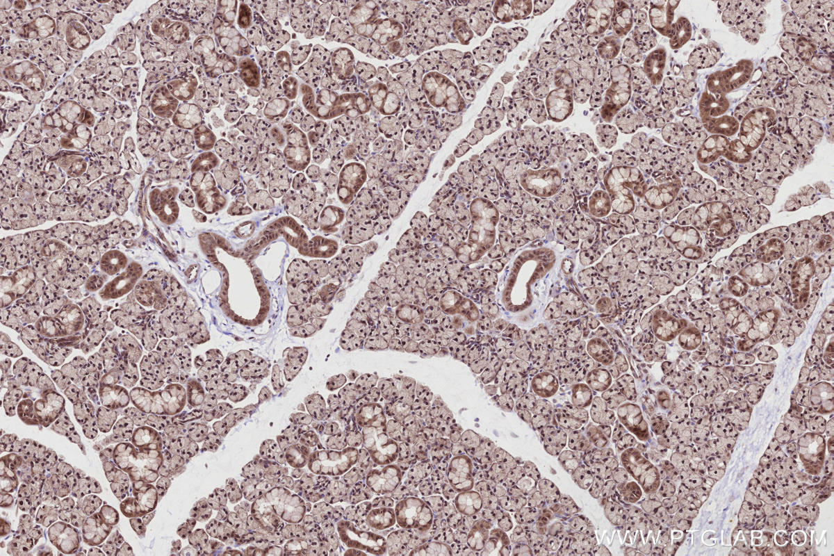 IHC staining of rat salivary gland using 13464-1-AP