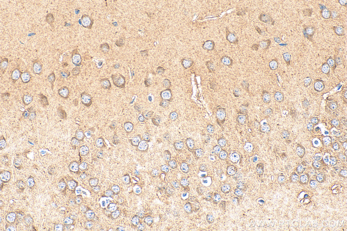IHC staining of mouse brain using 17675-1-AP