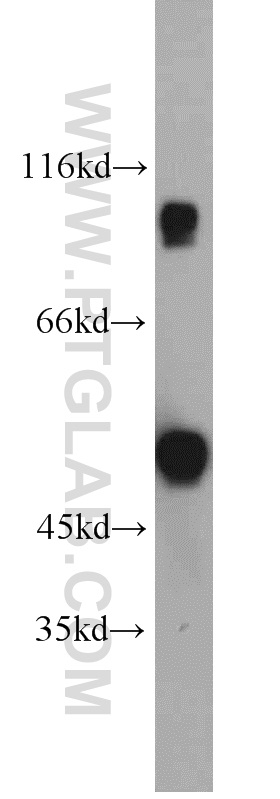 WB analysis of human testis using 12351-1-AP