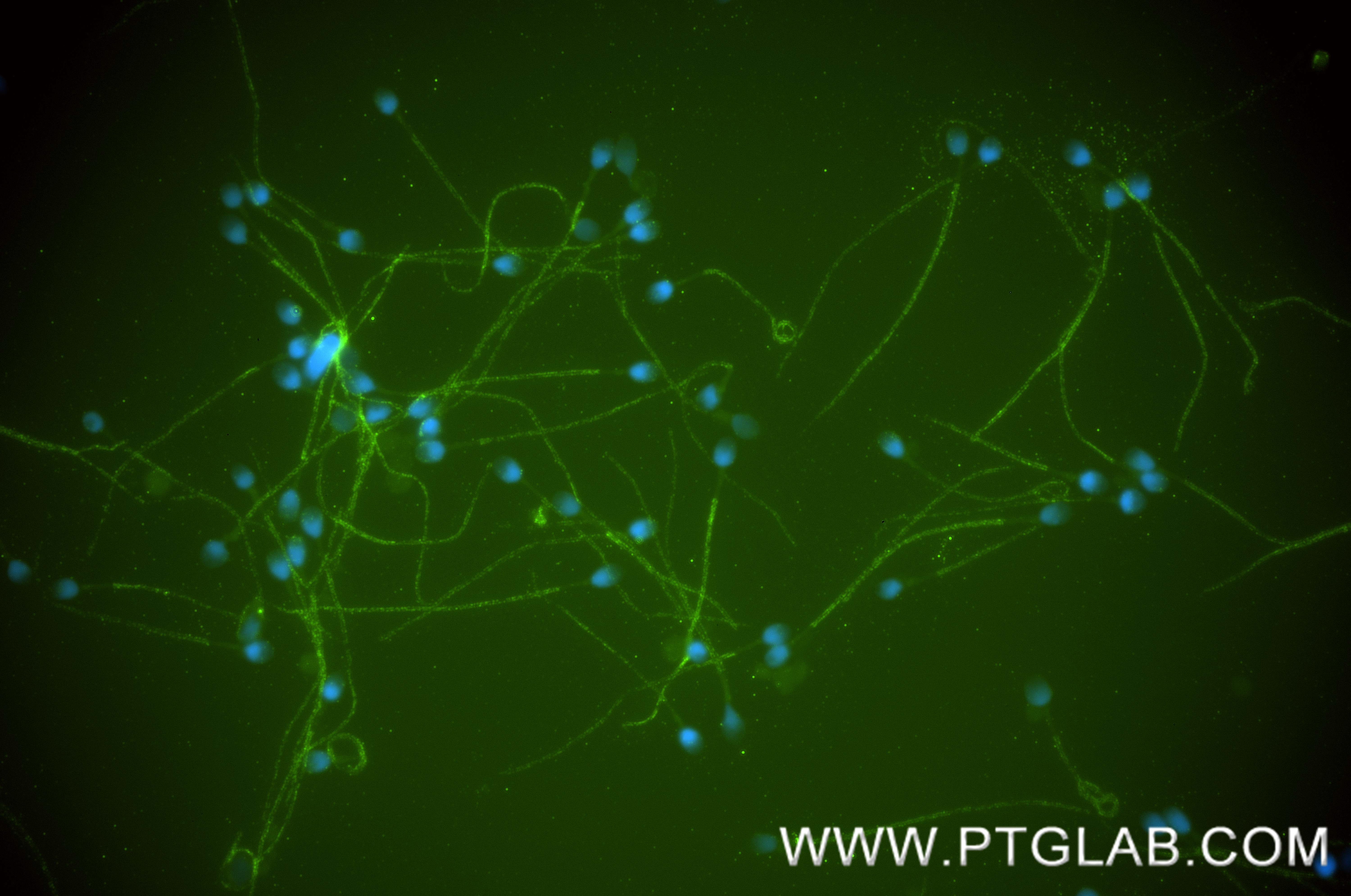 IF Staining of human sperm cells using 87074-1-RR (same clone as 87074-1-PBS)