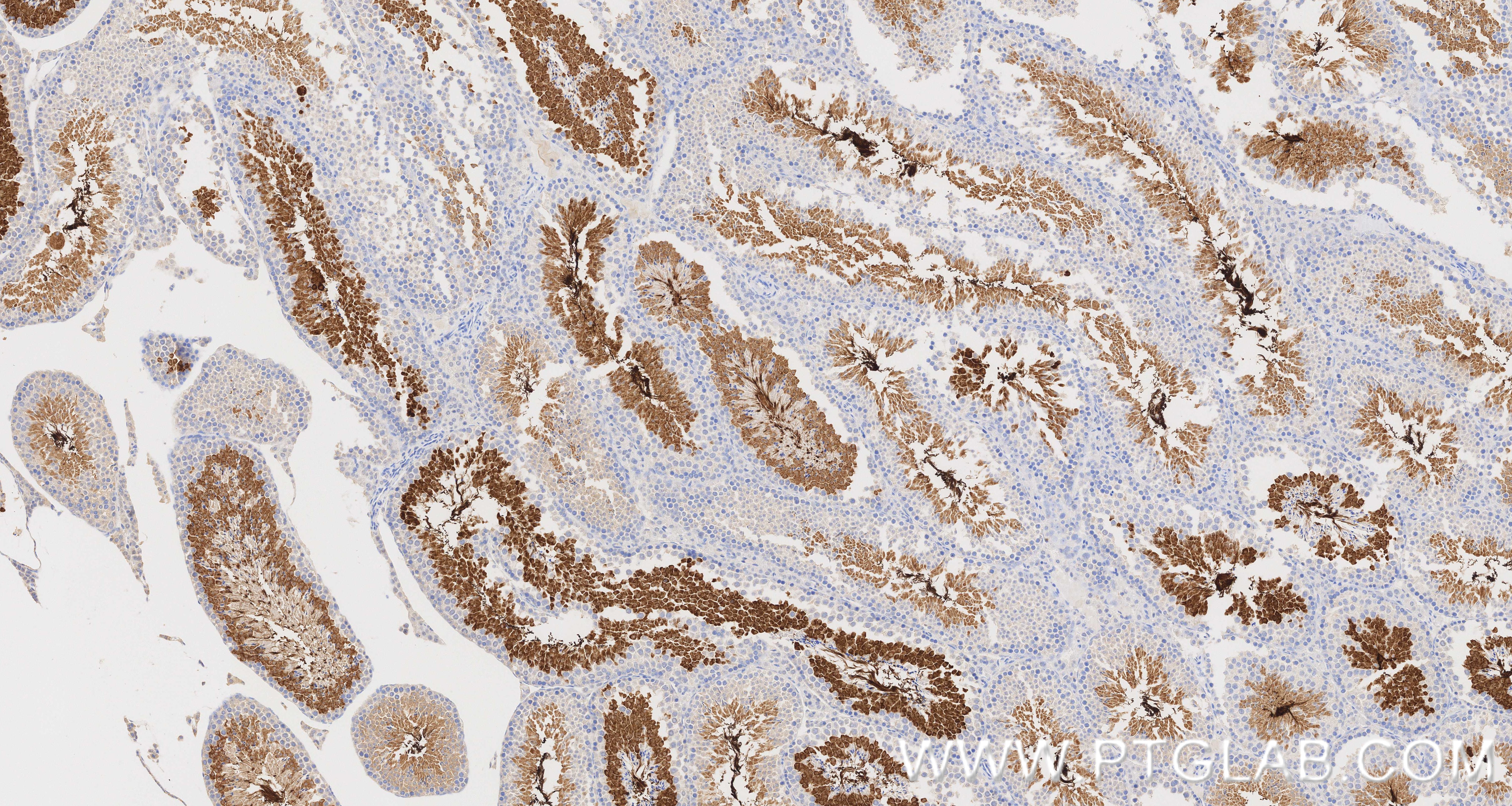 IHC staining of mouse testis using 87074-1-RR IHC staining of mouse testis using 87074-1-RR