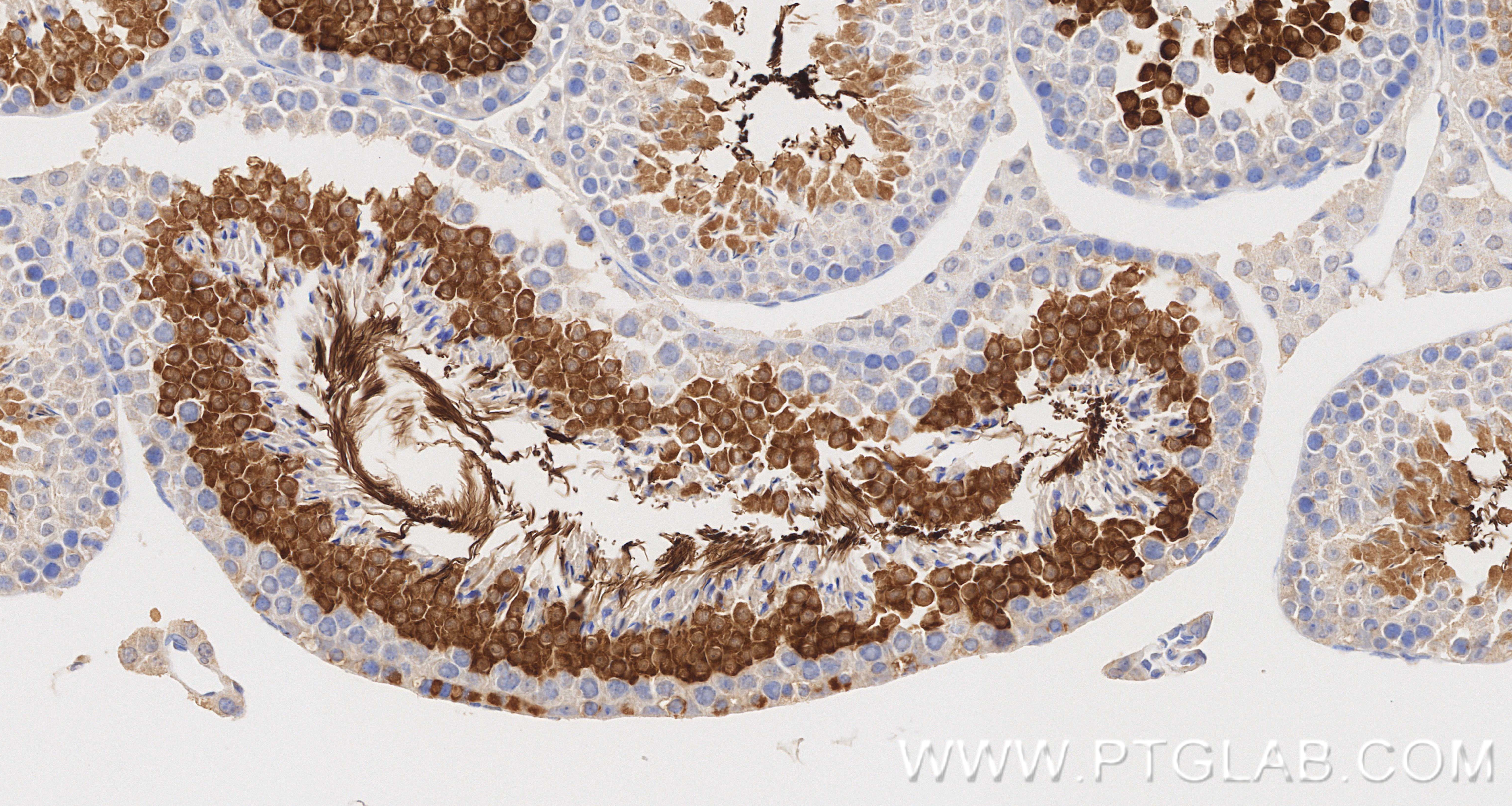 IHC staining of mouse testis using 87074-1-RR IHC staining of mouse testis using 87074-1-RR