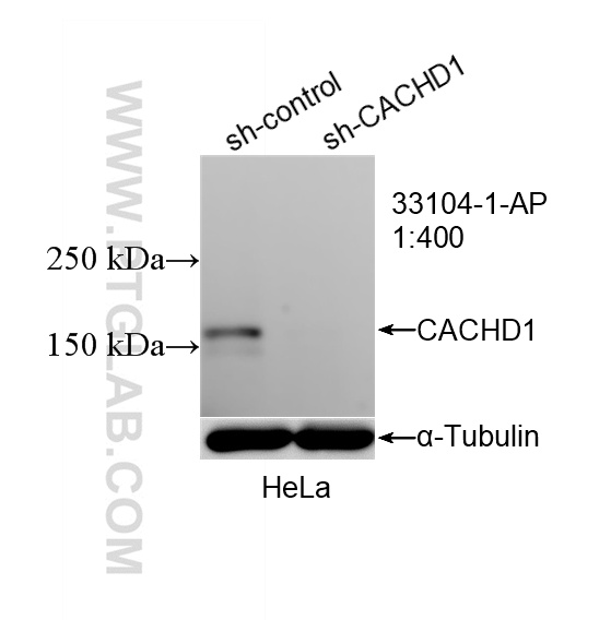WB analysis of HeLa using 33104-1-AP (same clone as 33104-1-PBS)