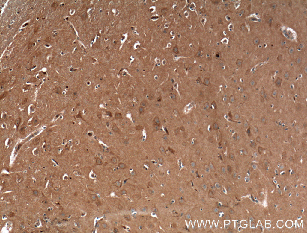 IHC staining of human brain using 27227-1-AP