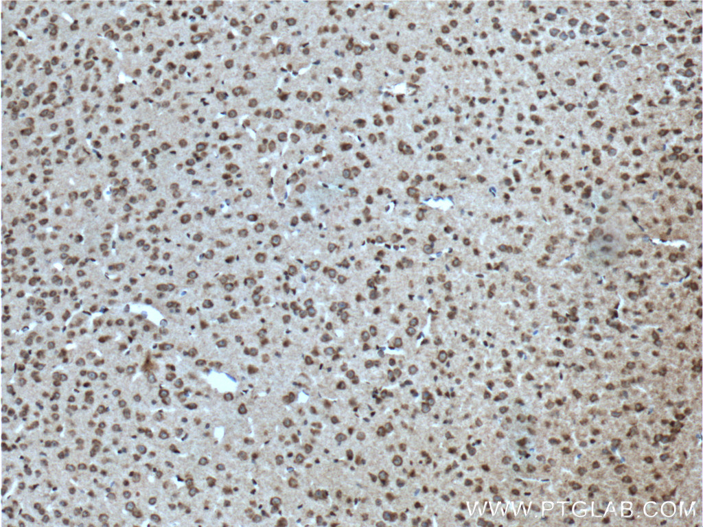 IHC staining of mouse brain using 19681-1-AP
