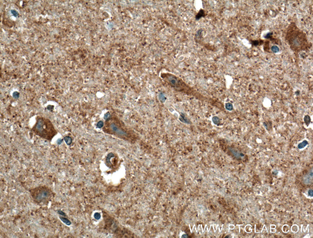 IHC staining of human brain using 27225-1-AP