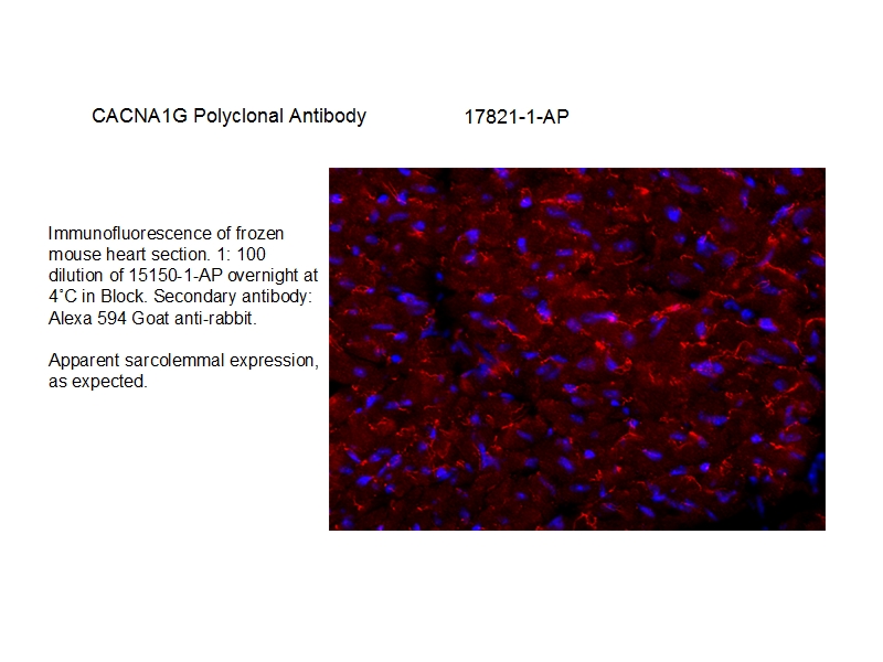 IF Staining of mouse heart tissue using 17821-1-AP