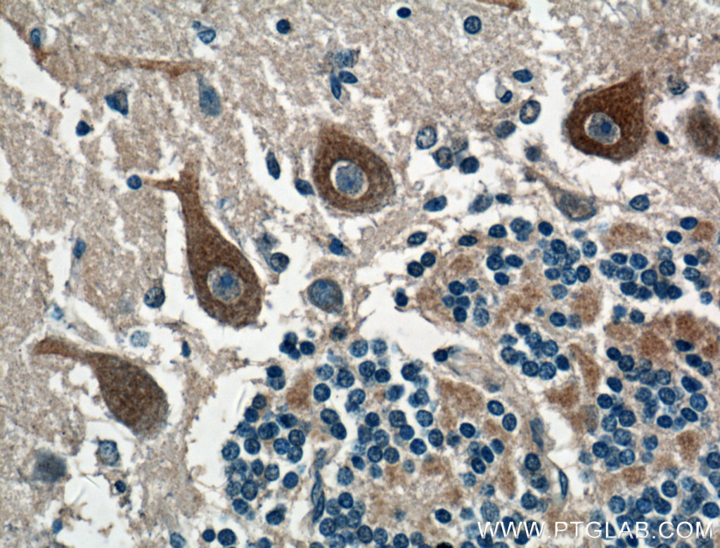 CACNA1G Polyclonal antibody