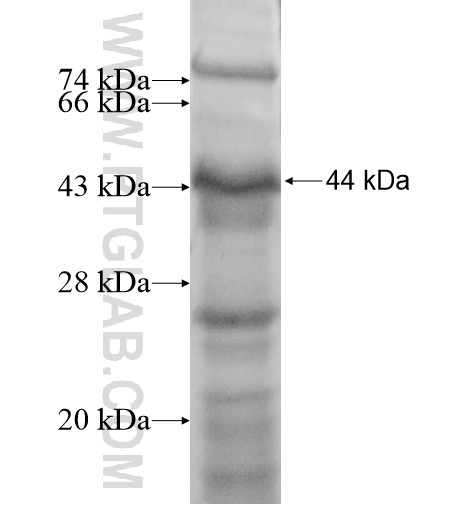 CACNA1G fusion protein Ag12398 SDS-PAGE CACNA1G fusion protein Ag12398 SDS-PAGE