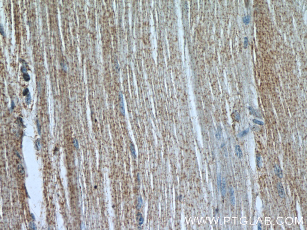 IHC staining of human skeletal muscle using 22279-1-AP