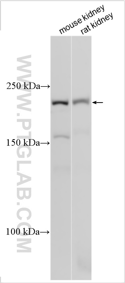 Various lysates were subjected to SDS PAGE followed by western blot with 22279-1-AP (CACNA1S antibody) at dilution of 1:1000 incubated at room temperature for 1.5 hours. WB analysis using 22279-1-AP
